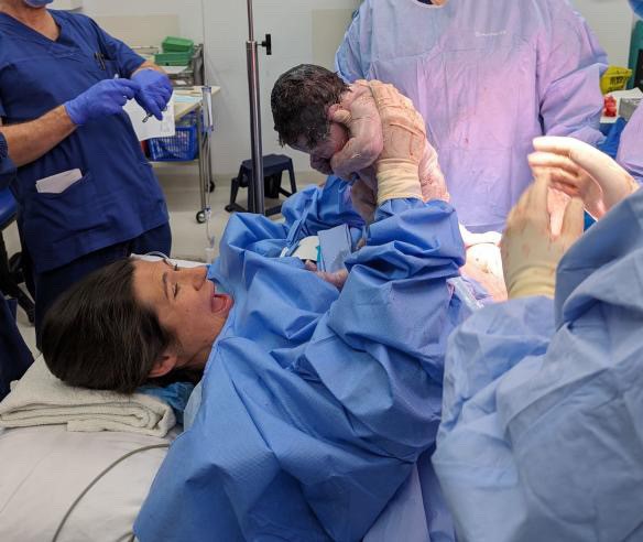 Curious about maternal assisted caesarean main image.jpg